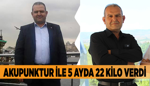 AKUPUNKTUR İLE 5 AYDA 22 KİLO VERDİ