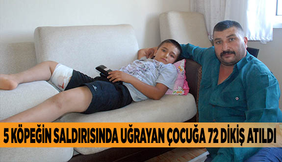 5 KÖPEĞİN SALDIRISINDA UĞRAYAN ÇOCUĞA 72 DİKİŞ ATILDI