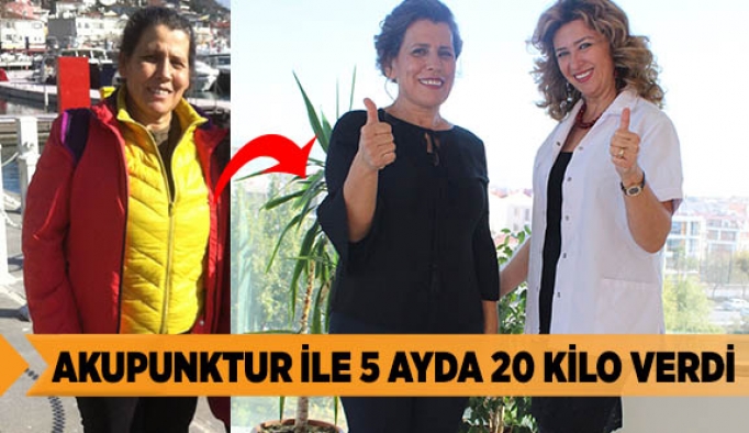 Akupunktur ile 5 ayda 20 kilo verdi