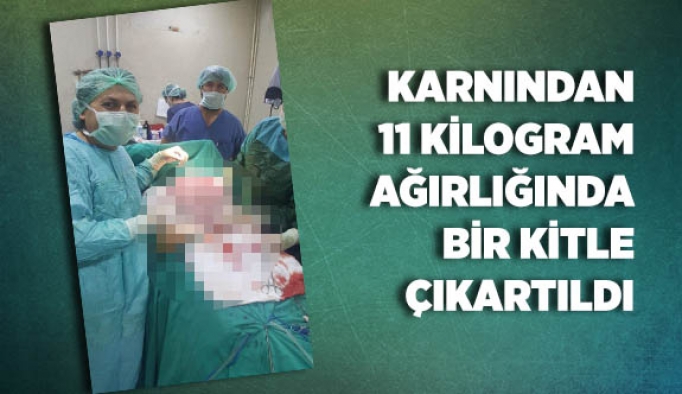 Karnından 11 kilogram ağırlığında bir kitle çıkartıldı