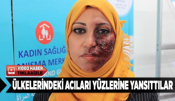 Ülkelerindeki acıları yüzlerine yansıttılar