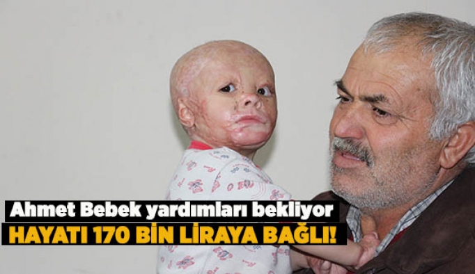 AHMET BEBEK YARDIMLARI BEKLİYOR