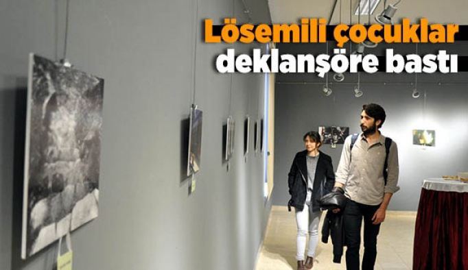 Lösemili çocuklar deklanşöre bastı