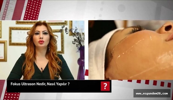 Fokus Ultrason ile yüz germe