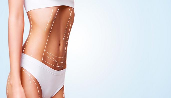 Liposuction Hakkında Bilinmesi Gerekenler