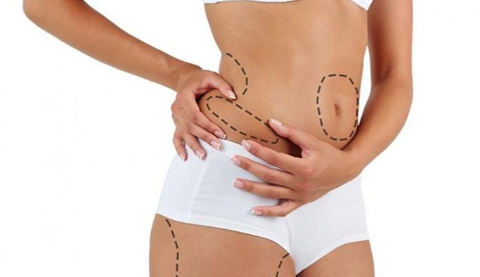 Liposuction Nasıl Uygulanır?
