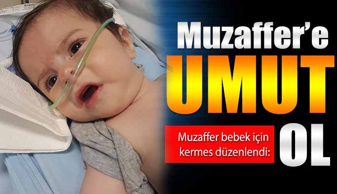 Muzaffer’e Bebeğe Umut Ol