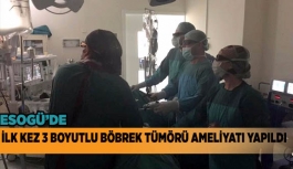 3 BOYUTLU BÖBREK TÜMÖRÜ AMELİYATI GERÇEKLEŞTİRİLDİ