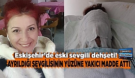 Ayrıldığı sevgilisinin yüzüne yakıcı madde attı